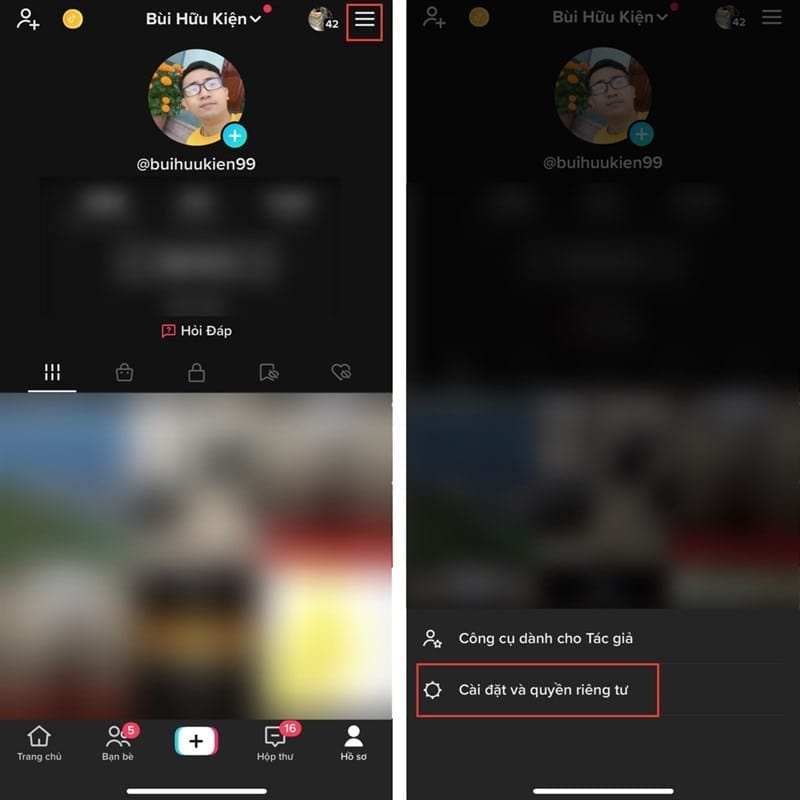 Cách xem lịch sử nạp xu trên TikTok Cách xem lịch sử nạp xu trên TikTok
